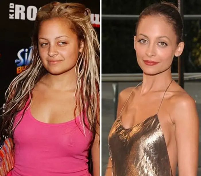 Celebrities Before And After Weight Loss (30 Pics)-03
